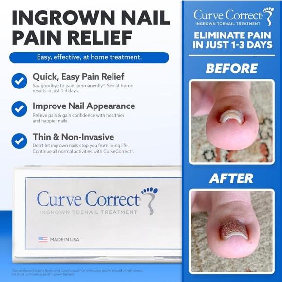 Curve Correct Ingrown Toenail Corrector Kit - Picture 4 of 9